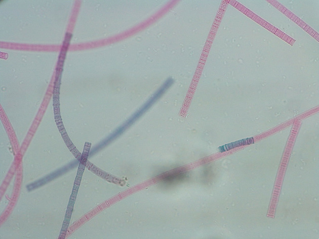 Oscillatoria Slides - Oscillatoria 01 100X